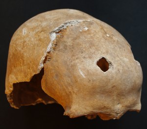 Uno dei crani chiodati recuperati durante gli scavi all'interno della Cattedrale di San Pietro a Bologna